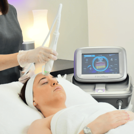 RF Microneedling in Milton Keynes